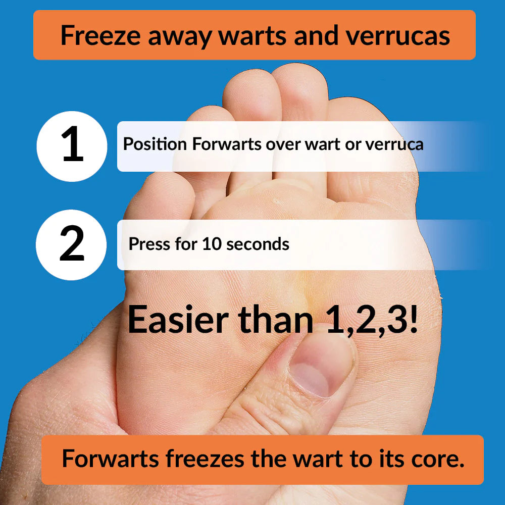 Forwarts Wart Remover