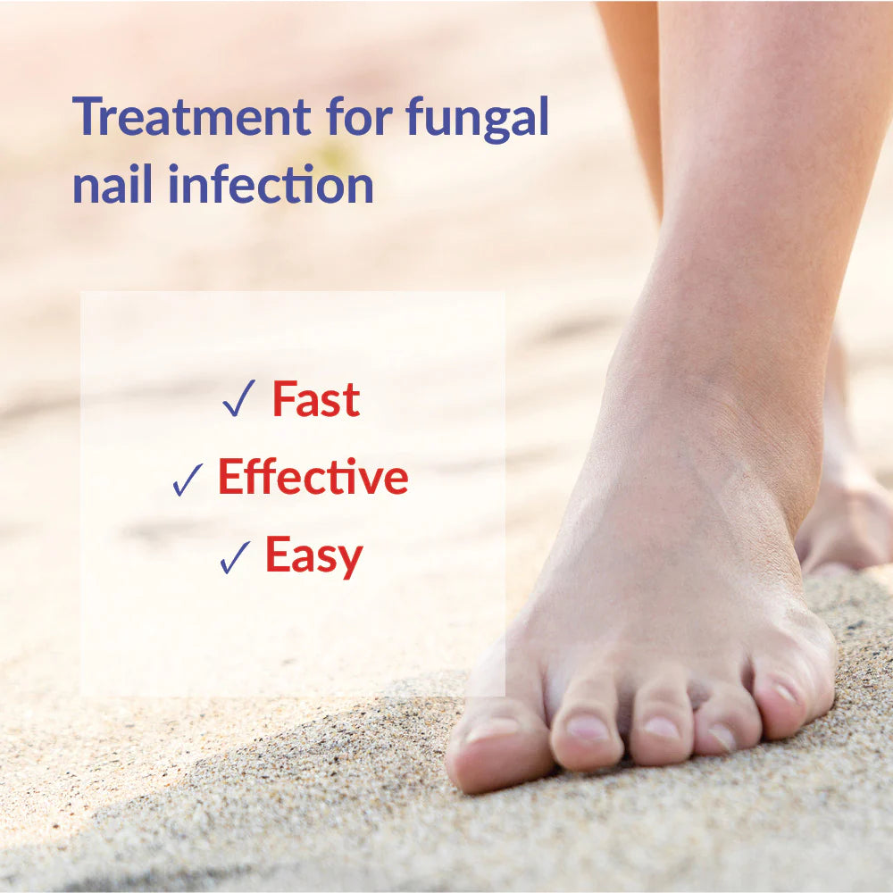 Pronail Fungal Nail Solution 10ml