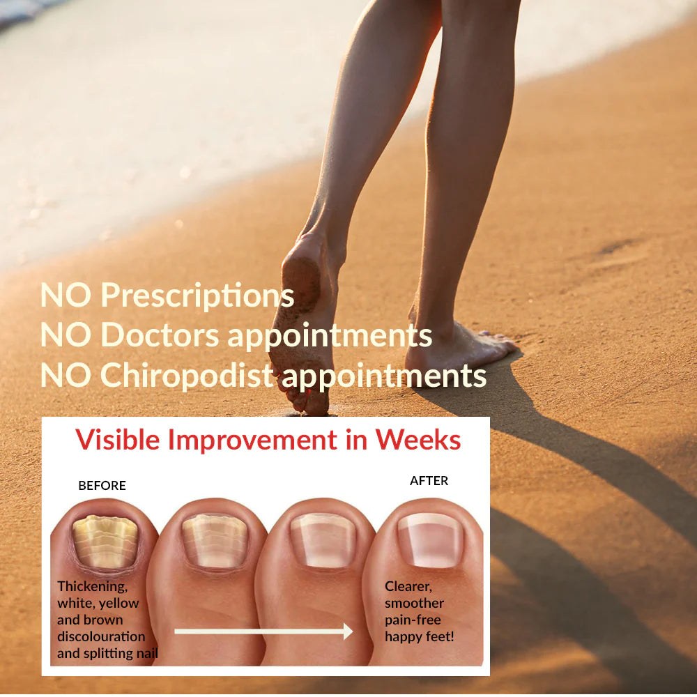 Pronail Fungal Nail Solution 10ml